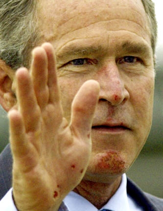 bushscrape